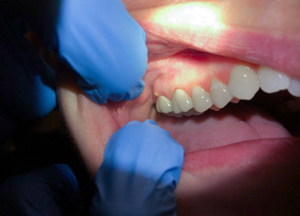  Garden Ridge, TX Emergency Dentist Pros